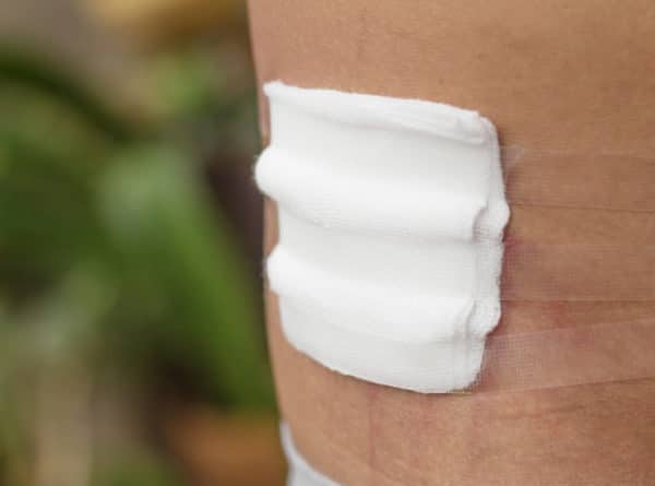 Advanced Wound Care | Caring for Your Wound | Healogics Advanced Wound Care | Caring for Your Wound | Healogics