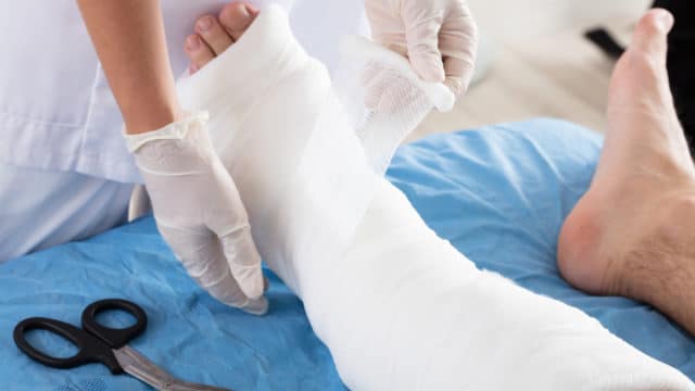 What You Need to Know About Chronic Wound Infections