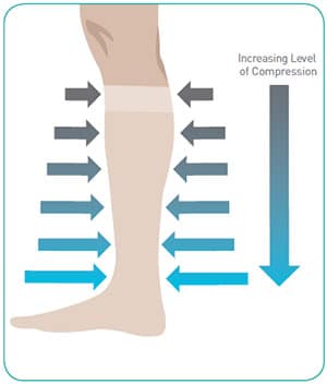 Illustration of increasing level of compression down leg