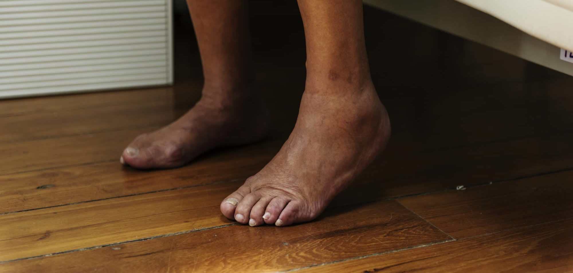 Drawing a Line from Foot Health to Chronic Wounds Landing Page