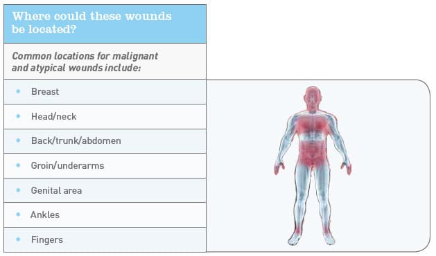 Wound Location Chart