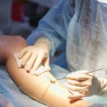 vascular surgery for wounds