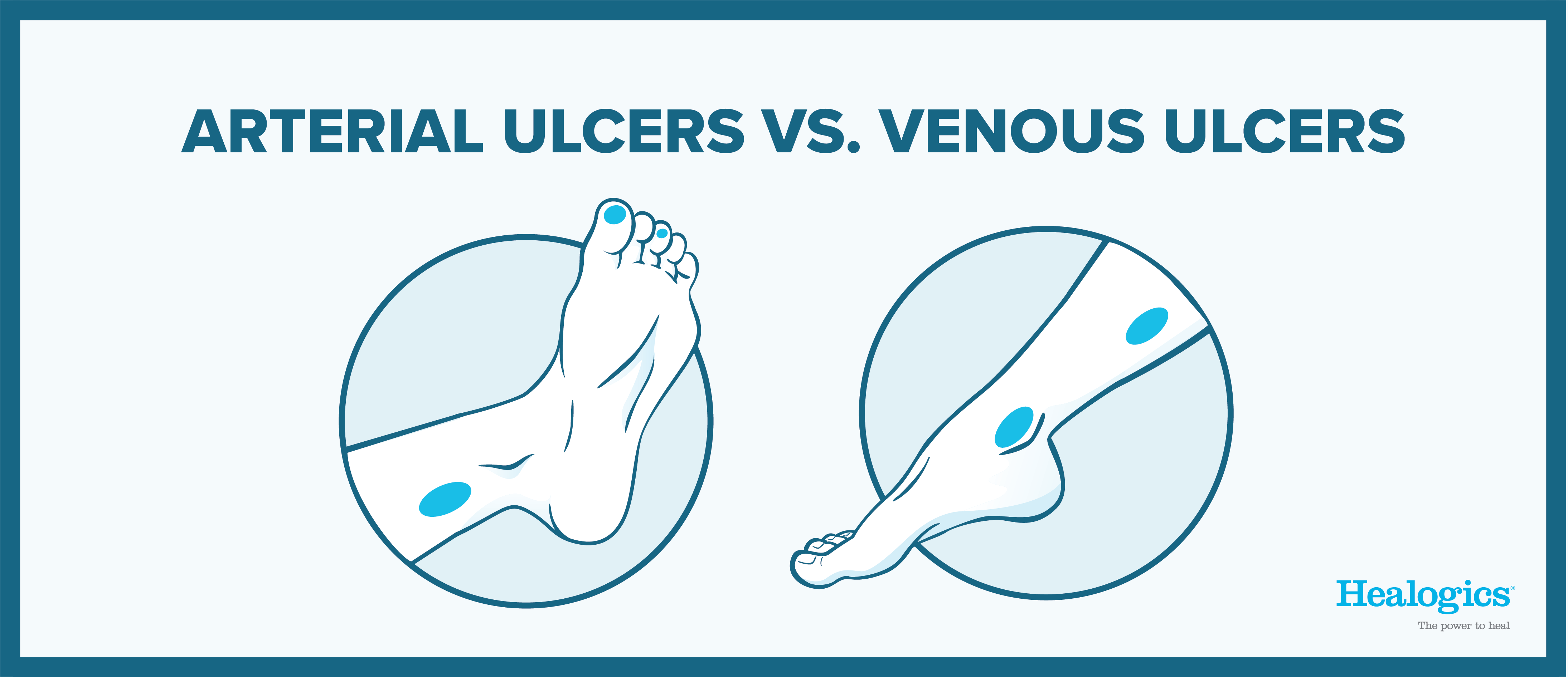 Arterial vs Venous Wounds Icons-05-05
