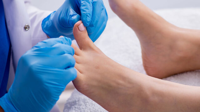 Prevention and Proper Care of Diabetic Foot <mark class=