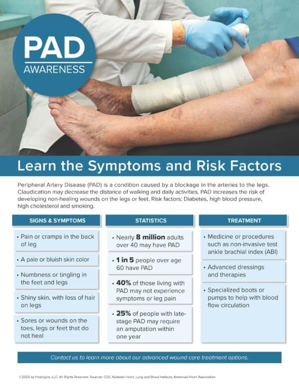 Peripheral Artery Disease (PAD)